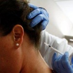 Botox para la Migraña: Seguridad a largo plazo y eficacia